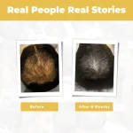 ScalpHeal Science-Backed Botanical Scalp Repair and Follicle Support Oil - Image 8